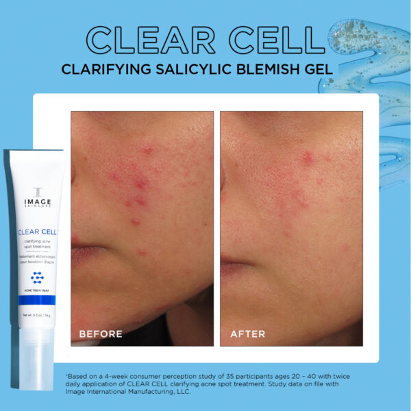 CLEAR CELL Clarifying Salicylic Blemish Gel 14g - Image 3